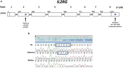 Two Unique Cases of X-linked SCID: A Diagnostic Challenge in the Era of Newborn Screening